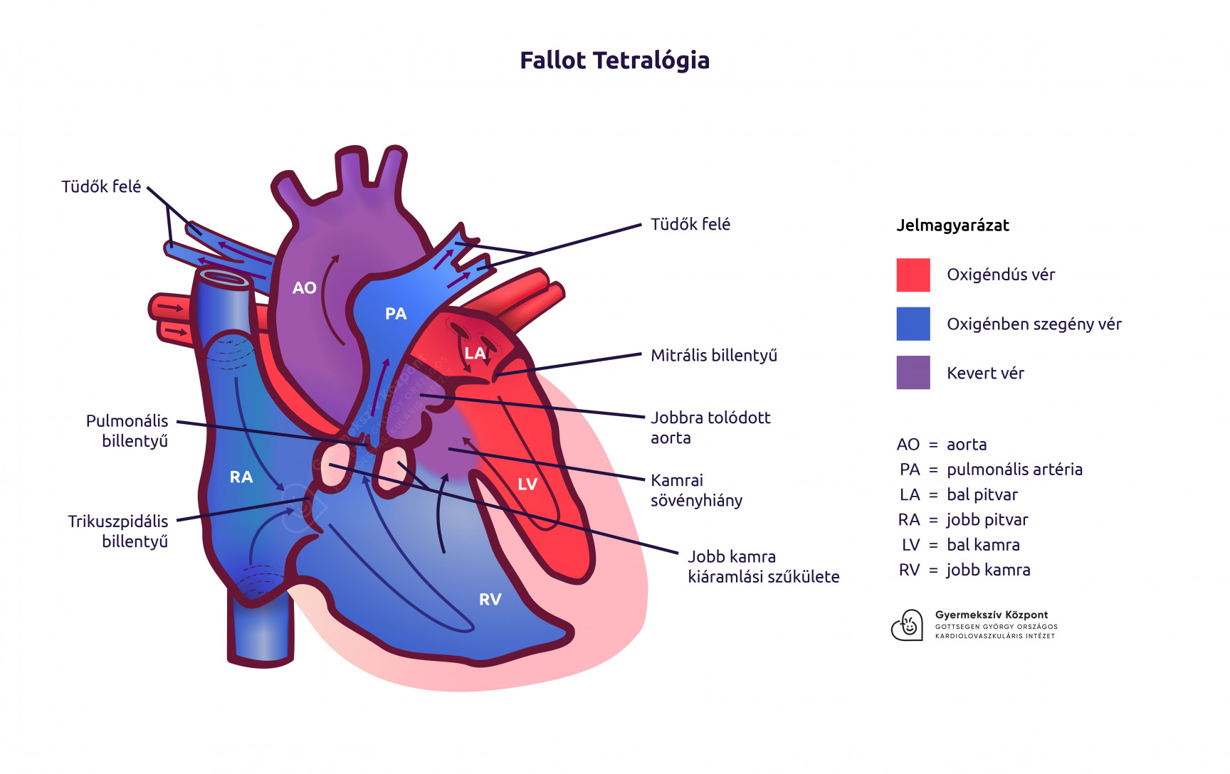 kezelése asd diabetes