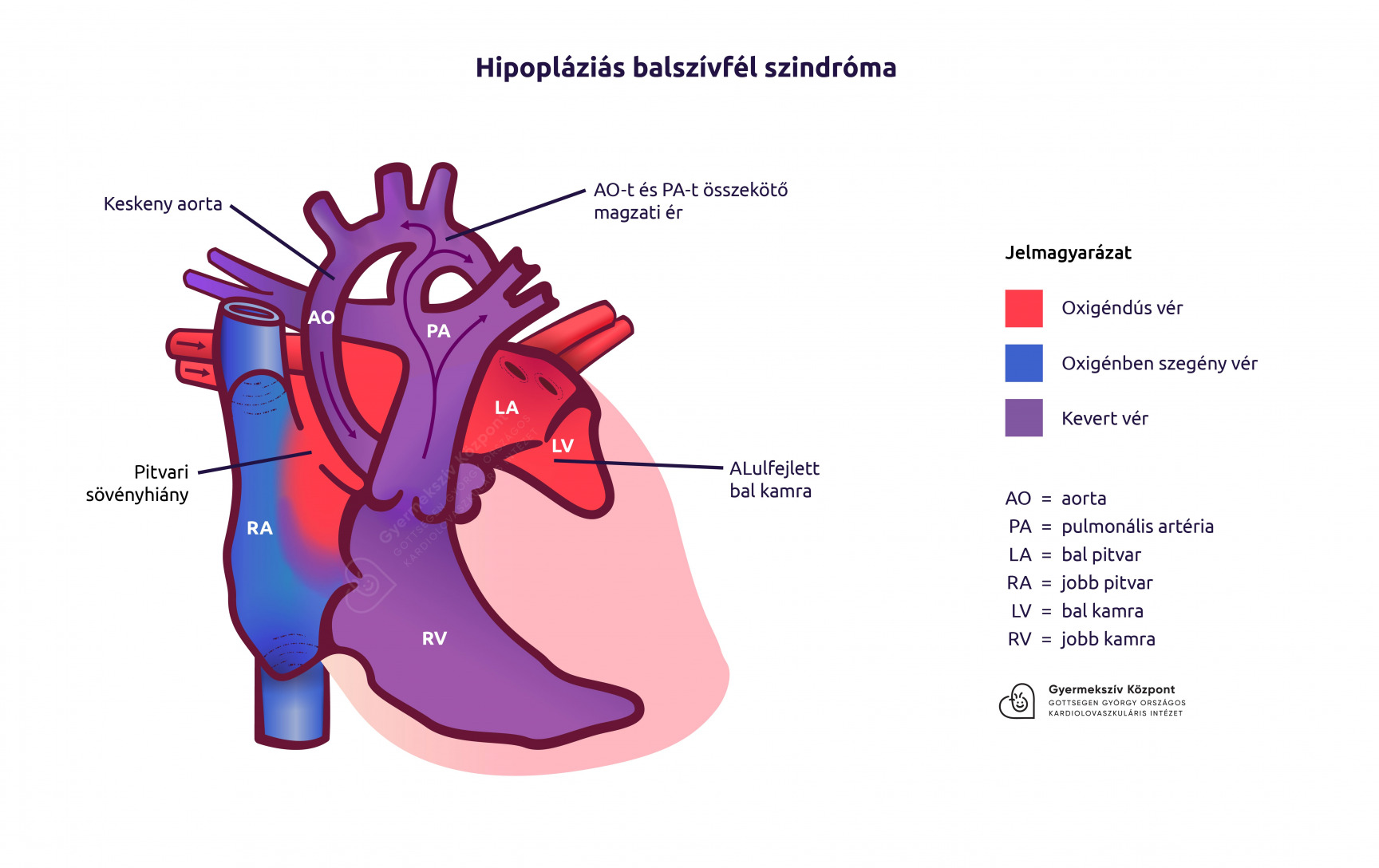 kapcsolat a száj és a szív egészsége között