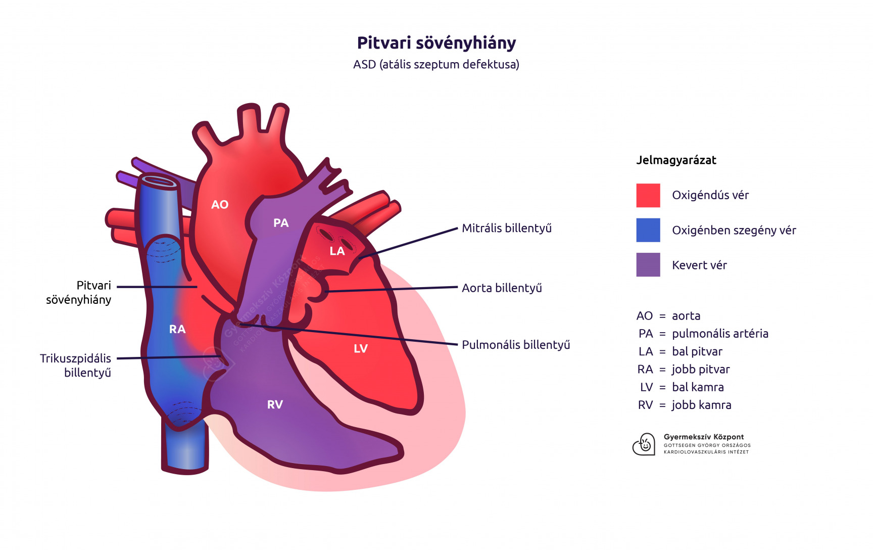 Az ESC/EACTS évi, a pitvarfibrilláció ellátására vonatkozó ajánlása | Cardiologia Hungarica